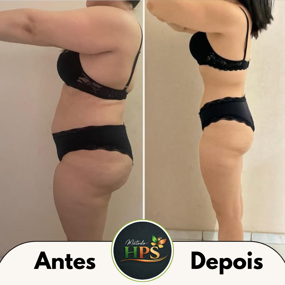 Thai Queiroz — Antes e depois — Instituto Clarissa Rios