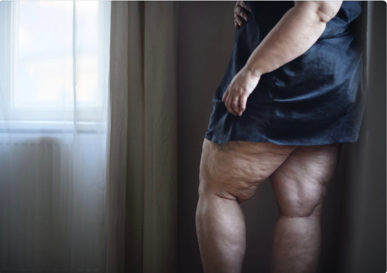 Mulher 40+ exausta e frustrada com seu corpo